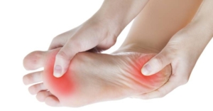 Fasciopatía plantar